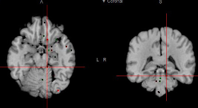 Genes, Brain, Social Behaviour and Schizophrenia